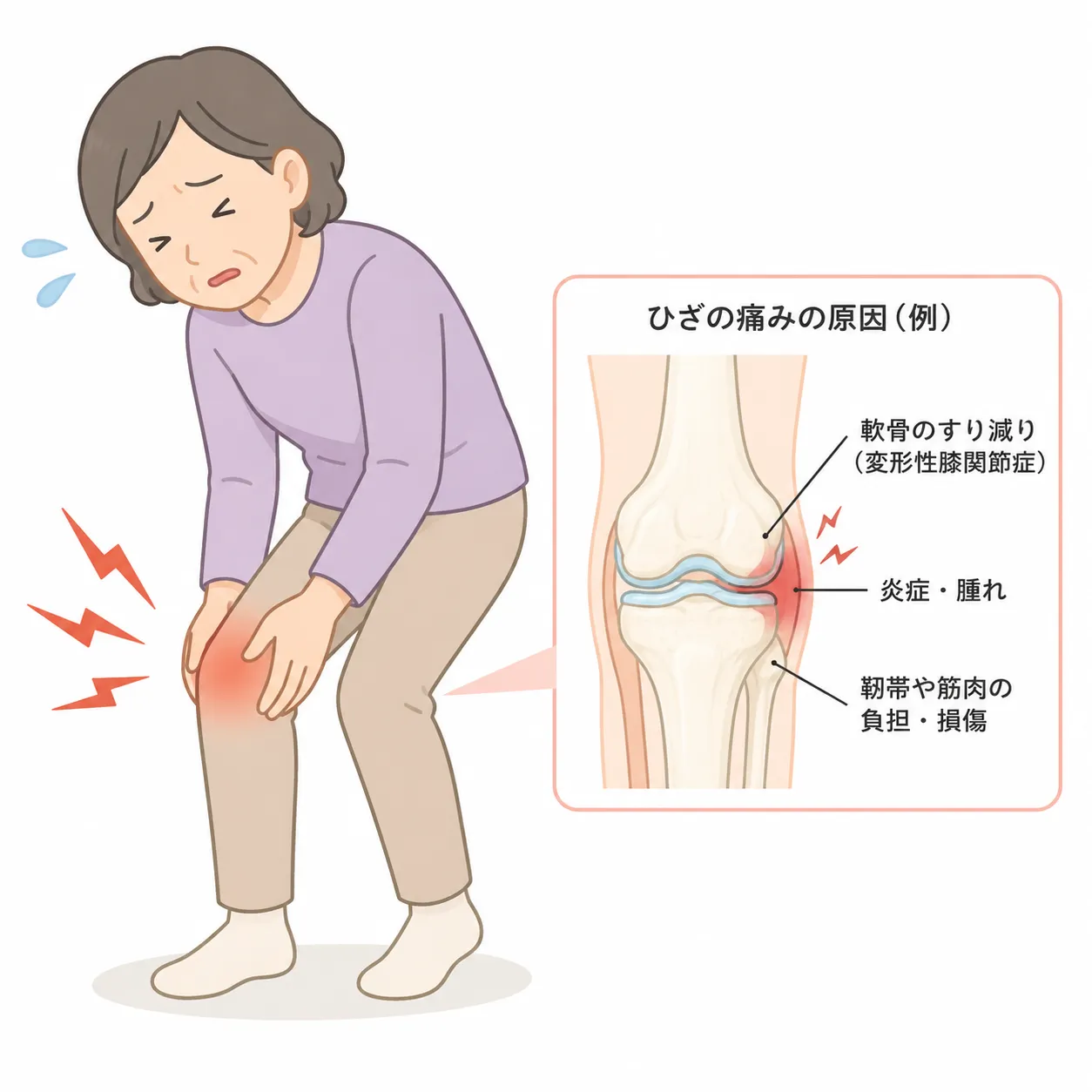歩くとつらいひざ痛に！鍼灸と自宅でできる運動を紹介